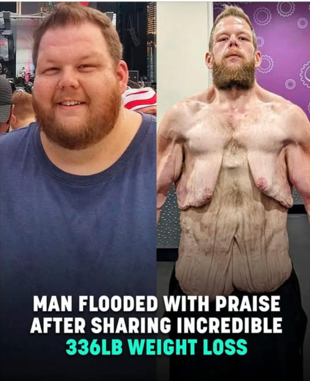 Internet praises man for 360lb weight loss