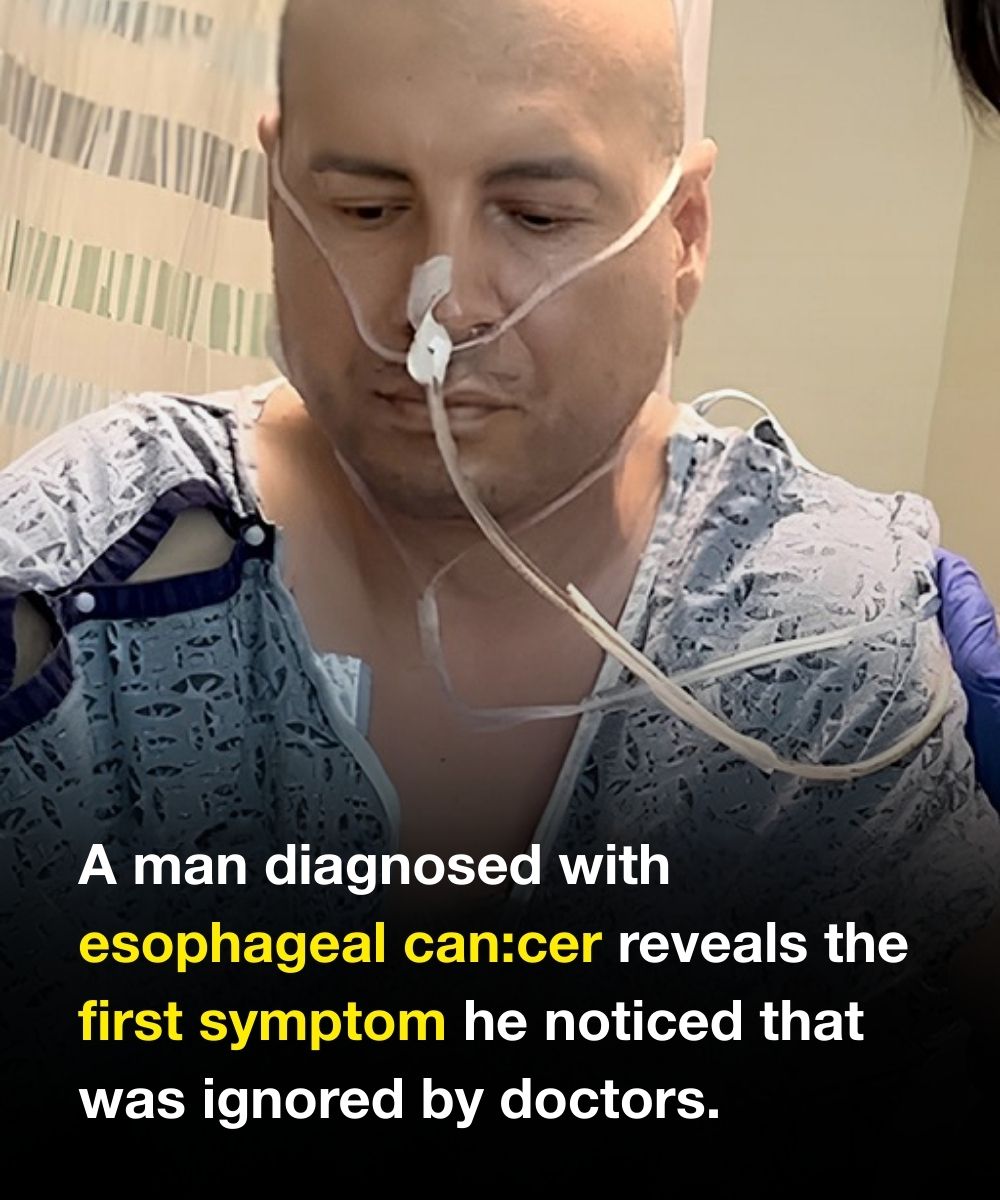 Man diagnosed with esophageal can:cer reveals the first sign he noticed, but doctors ignored