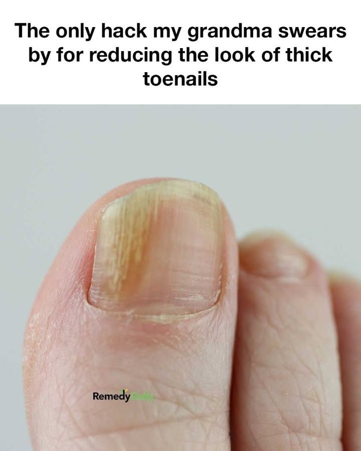 Thanks, Nana!. Full article